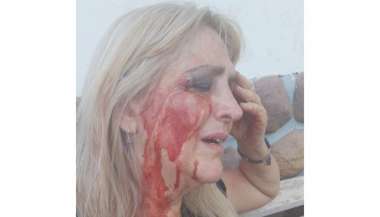 La mujer agredida por un turista francés.